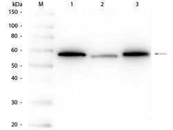 AKT Monoclonal Antibody (14E5.16C8.25F6), Rockland:Antibodies:Primary Antibodies