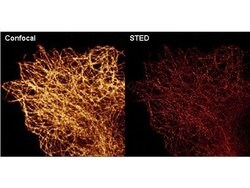 alpha-Tubulin Monoclonal Antibody (17H11.F10), Rockland:Antibodies:Primary