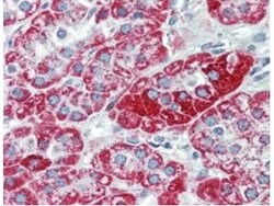 TRPC6 Monoclonal Antibody (3F2.H10.F2), Rockland:Antibodies:Primary Antibodies