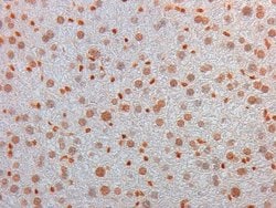 AKT3 Monoclonal Antibody (25F6.F6.D8), Rockland 100 &mu;g; Unconjugated:Antibodies,