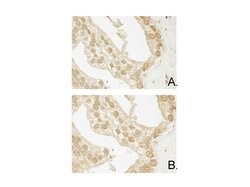AKT3 Monoclonal Antibody (25F6.F6.D8), Rockland 100 &mu;g; Unconjugated:Antibodies,