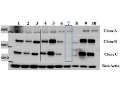 AKT3 Monoclonal Antibody (25F6.F6.D8), Rockland 100 &mu;g; Unconjugated:Antibodies,