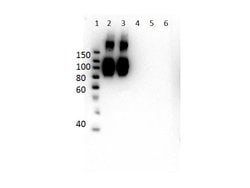 Hemoglobin A (beta chain) Monoclonal Antibody (14G2.G11.F11), Rockland