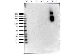 Hemoglobin beta S Monoclonal Antibody (23E5.H6.G6.C1.H7.F7.G9.F6), Rockland