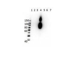 Hemoglobin beta C Monoclonal Antibody (15C2.C11.F2.G11), Rockland 100 &mu;g;