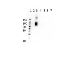 Hemoglobin beta A-2 Monoclonal Antibody (21G1.F1.B9.G9.D11), Rockland 25