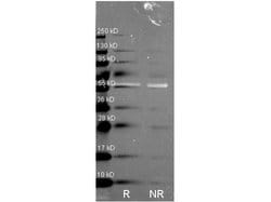 Catalase Polyclonal Antibody, Rockland 100 &mu;g; Unconjugated:Antibodies,