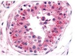 NRF1Rabbit anti-Mouse, Polyclonal, Rockland 500 &mu;g; Unconjugated:Antibodies,