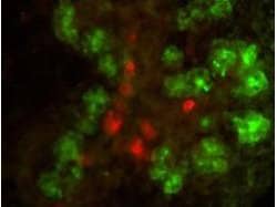 Elastase Polyclonal Antibody, Rockland 100 &mu;g; Unconjugated:Antibodies,