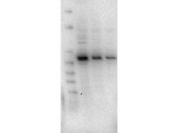 AKT2 Monoclonal Antibody (11F6.B2), Rockland:Antibodies:Primary Antibodies
