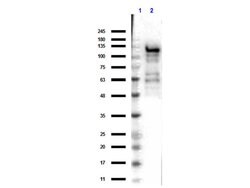 beta Galactosidase Polyclonal Antibody, Rockland 100 &mu;g; Unconjugated:Antibodies,