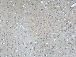 NCOR1 Rabbit anti-Human, Mouse, Rat, Polyclonal, Proteintech:Antibodies:Primary