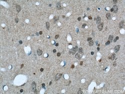 NCOR1 Rabbit anti-Human, Mouse, Rat, Polyclonal, Proteintech:Antibodies:Primary