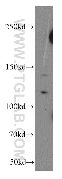 NCOR1 Rabbit anti-Human, Mouse, Rat, Polyclonal, Proteintech:Antibodies:Primary