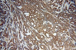 NCOR1 Rabbit anti-Human, Mouse, Rat, Polyclonal, Proteintech:Antibodies:Primary