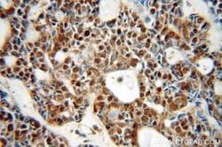 NCOR1 Rabbit anti-Human, Mouse, Rat, Polyclonal, Proteintech:Antibodies:Primary