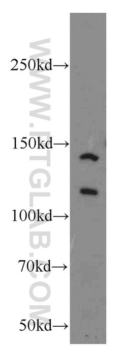 NCOR1 Rabbit anti-Human, Mouse, Rat, Polyclonal, Proteintech:Antibodies:Primary