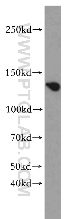 ZBTB40 Rabbit anti-Human, Polyclonal, Proteintech:Antibodies:Primary Antibodies