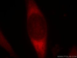 PDZD2 Rabbit anti-Human, Mouse, Rat, Polyclonal, Proteintech 150 &mu;L;