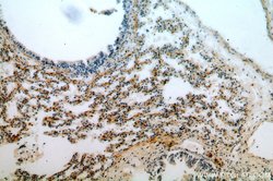PDZD2 Rabbit anti-Human, Mouse, Rat, Polyclonal, Proteintech 150 &mu;L;