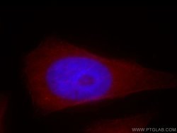 MPRIP Rabbit anti-Human, Mouse, Rat, Polyclonal, Proteintech 150 &mu;L;