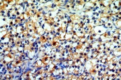 MPRIP Rabbit anti-Human, Mouse, Rat, Polyclonal, Proteintech 150 &mu;L;