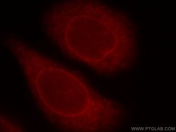 ZC3H4 Rabbit anti-Human, Mouse, Polyclonal, Proteintech 20 &mu;L; Unconjugated:Antibodies,