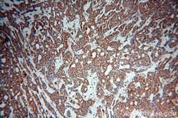 ZC3H4 Rabbit anti-Human, Mouse, Polyclonal, Proteintech 20 &mu;L; Unconjugated:Antibodies,