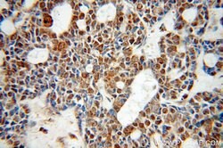 ZC3H4 Rabbit anti-Human, Mouse, Polyclonal, Proteintech 20 &mu;L; Unconjugated:Antibodies,