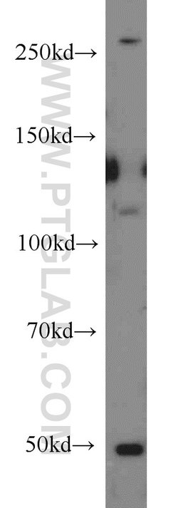MED12L Rabbit anti-Human, Mouse, Rat, Polyclonal, Proteintech 150 &mu;L;