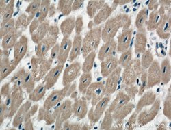 TNS1 Rabbit anti-Human, Mouse, Polyclonal, Proteintech 150 &mu;L; Unconjugated:Antibodies,