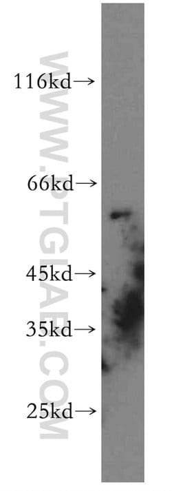 GPR101 Rabbit anti-Human, Non-human primate, Polyclonal, Proteintech 150