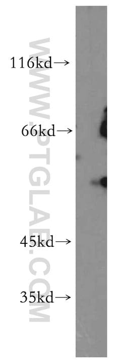 GPR101 Rabbit anti-Human, Non-human primate, Polyclonal, Proteintech 150