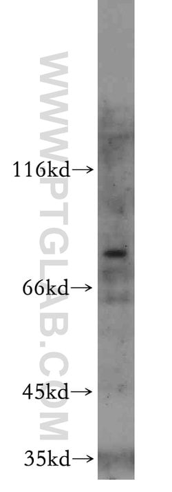 MYSM1 Rabbit anti-Human, Polyclonal, Proteintech 150 &mu;L; Unconjugated:Antibodies,