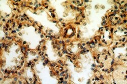 CPNE8 Rabbit anti-Human, Mouse, Rat, Polyclonal, Proteintech 150 &mu;L;