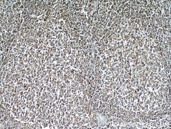 CD45 Rabbit anti-Human, Mouse, Rat, Polyclonal, Proteintech:Antibodies:Primary
