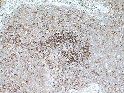 CD45 Rabbit anti-Human, Mouse, Rat, Polyclonal, Proteintech:Antibodies:Primary