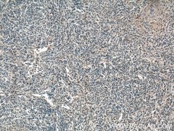 CD45 Rabbit anti-Human, Mouse, Rat, Polyclonal, Proteintech:Antibodies:Primary