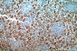 FAM96B Rabbit anti-Human, Mouse, Rat, Polyclonal, Proteintech:Antibodies:Primary
