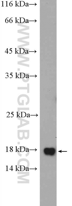 FAM96B Rabbit anti-Human, Mouse, Rat, Polyclonal, Proteintech:Antibodies:Primary