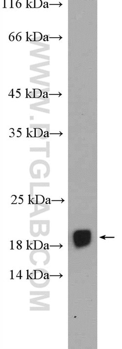 FAM96B Rabbit anti-Human, Mouse, Rat, Polyclonal, Proteintech:Antibodies:Primary