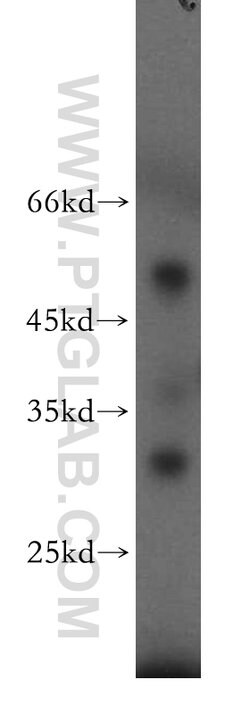 C14orf94 Rabbit anti-Human, Mouse, Polyclonal, Proteintech:Antibodies:Primary