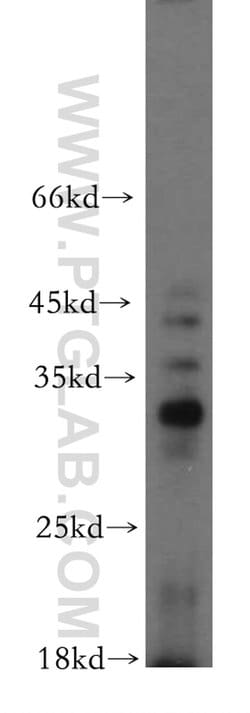 C14orf94 Rabbit anti-Human, Mouse, Polyclonal, Proteintech:Antibodies:Primary