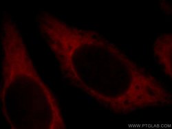 CUEDC2 Rabbit anti-Human, Mouse, Polyclonal, Proteintech:Antibodies:Primary