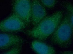CUEDC2 Rabbit anti-Human, Mouse, Polyclonal, Proteintech:Antibodies:Primary