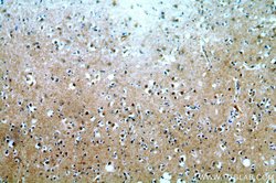 CUEDC2 Rabbit anti-Human, Mouse, Polyclonal, Proteintech:Antibodies:Primary