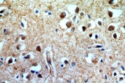 CUEDC2 Rabbit anti-Human, Mouse, Polyclonal, Proteintech:Antibodies:Primary