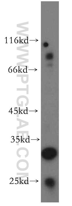 CUEDC2 Rabbit anti-Human, Mouse, Polyclonal, Proteintech:Antibodies:Primary