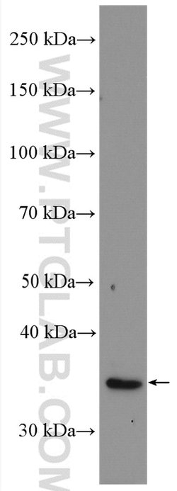 CUEDC2 Rabbit anti-Human, Mouse, Polyclonal, Proteintech:Antibodies:Primary