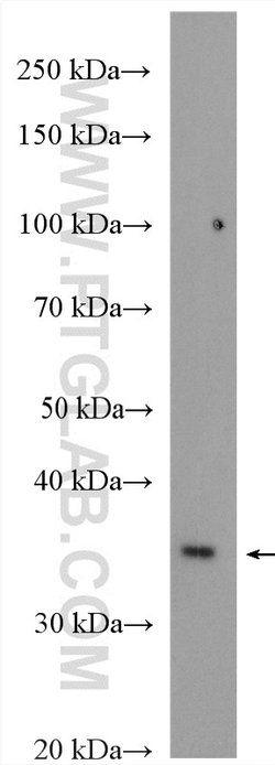 CUEDC2 Rabbit anti-Human, Mouse, Polyclonal, Proteintech:Antibodies:Primary